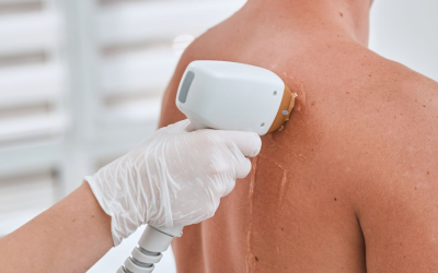 Erkekler İçin Kozmetik Dermatoloji