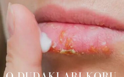 O Dudakları Koru Kızım!