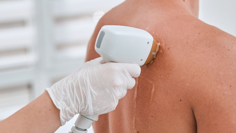 Erkekler İçin Kozmetik Dermatoloji