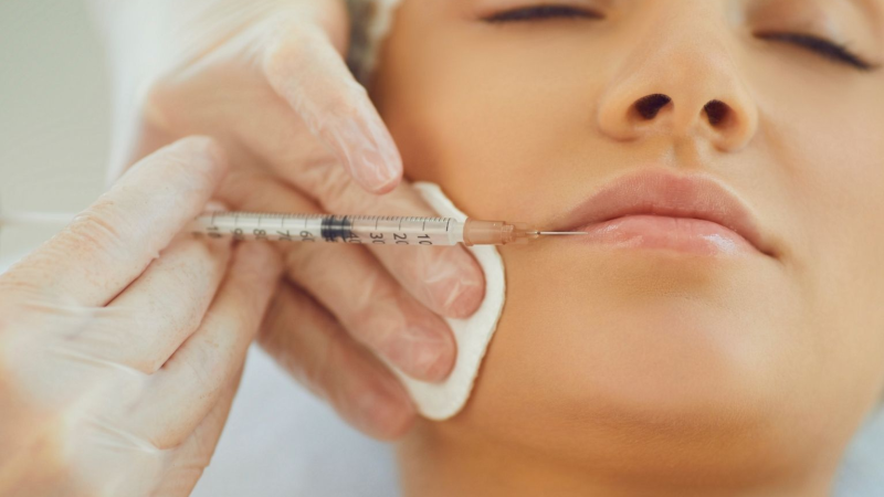 Dermal Filler Treatments